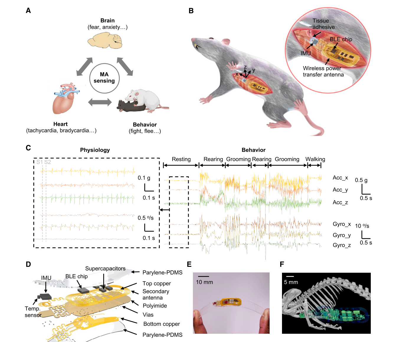 Figure 1 from Ouyang et al. 2024: system concept, device design, and implant location