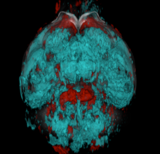 Anesthesia and Consciousness
